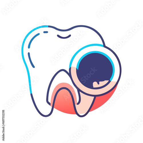 Dental health caries close-up with decay treatment graphic illustration