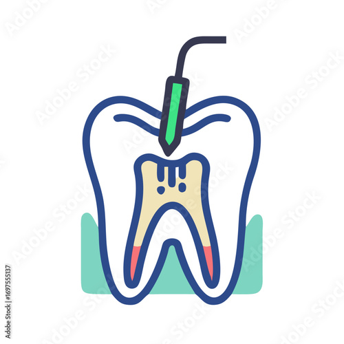 Dental treatment illustration depicting root canal procedure in stylized art