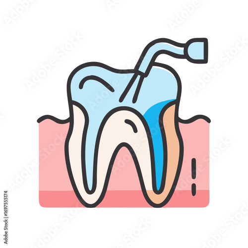 Root Canal Treatment Illustration Graphic on Black Background