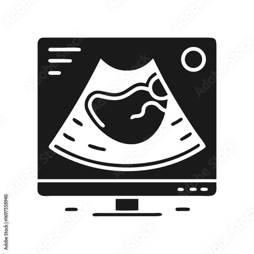 Ultrasound scan of a fetus on a monitor screen