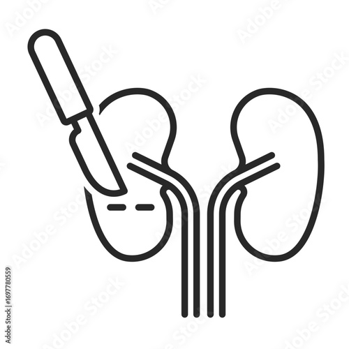 Kidney surgery line icon vector for medical and healthcare clip art.