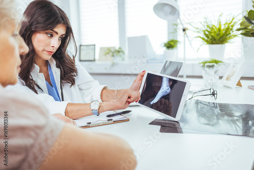 Doctor Explaining X-Ray Results on a Tablet to a Patient in a Modern Clinic