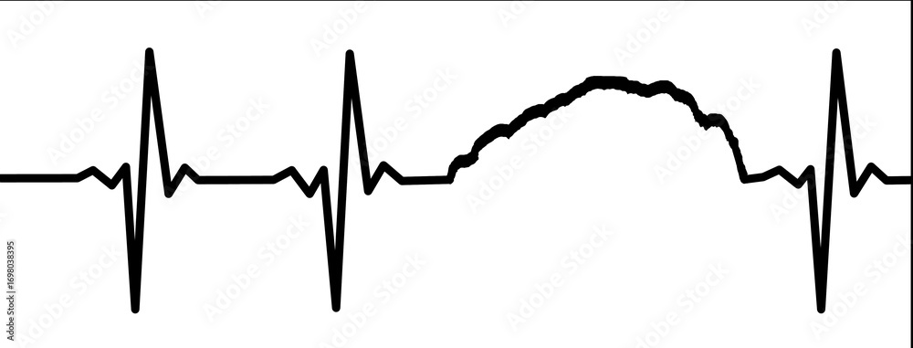 Fototapeta premium Electrocardiogram Waves - Barre des Ecrins