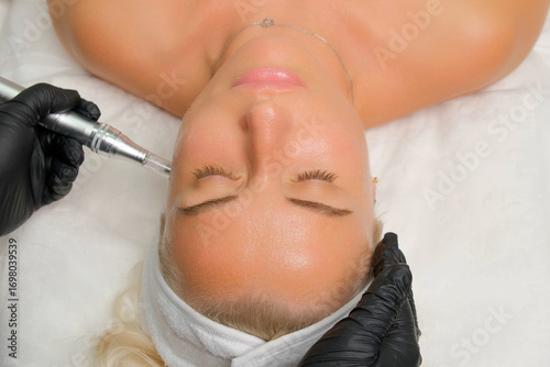 Close-up of a woman undergoing microneedling facial treatment in a beauty clinic, a professional skincare procedure aimed at rejuvenation, anti-aging, and improving skin texture. RF lifting.
