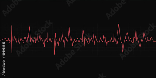 Heartbeat wave graph on monitor illustration