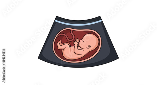 Illustrated ultrasound scan showing a human fetus developing inside the womb.