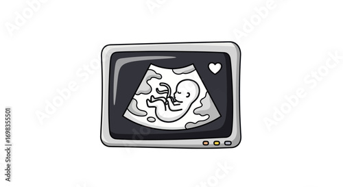 Ultrasound Image of a Fetus in Utero.
