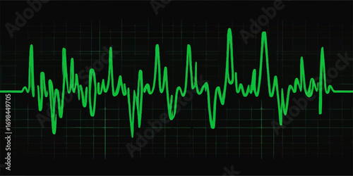 Vector illustration of a medical heartbeat monitor graph showing a sound wave pulse on a green and blue background