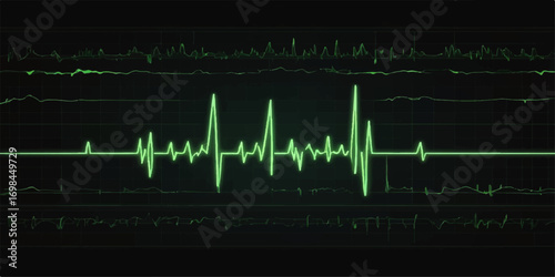 The rhythmic green wave of a heartbeat on a hospital EKG monitor