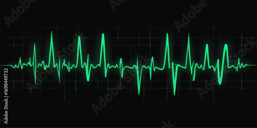 Green EKG wave graphic on a hospital monitor showing a heartbeat pulse