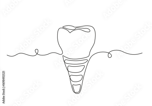 One continuous line illustration of a dental implant, isolated on white background. Line art of dental implant. Hand drawn one line vector. Editable stroke