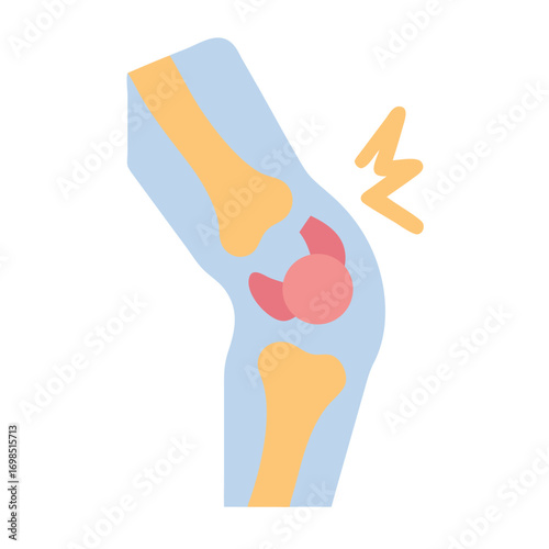 Stylized knee joint illustration depicting injury and pain