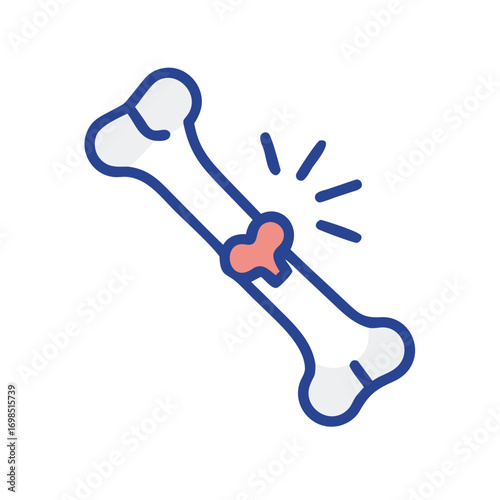 Fractured bone illustration showing bone injury in minimalist style