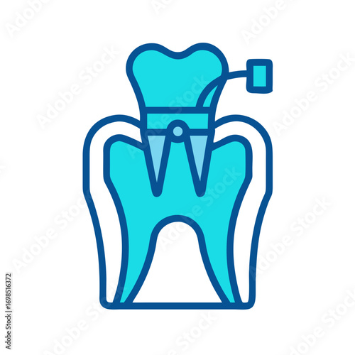 Graphic tooth restoration process illustration in blue tones on black
