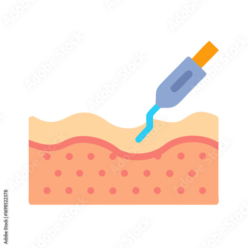 Dermatology treatment performing procedure on skin layer illustration