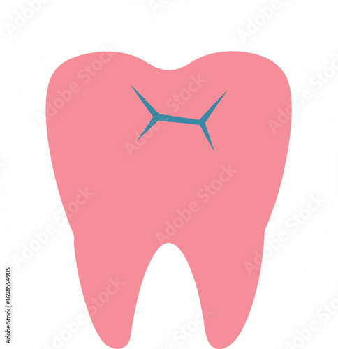 "Vector icon of a cracked tooth, red damaged area, flat style"


