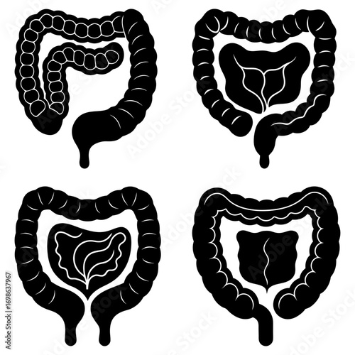 Four anatomical illustrations of the large intestine in black and white with varying internal structures