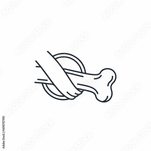 Depicting broken bone in an illustration. Broken bone image shows fracture of human bone in a diagrammatic way, highlighting the injury or trauma.