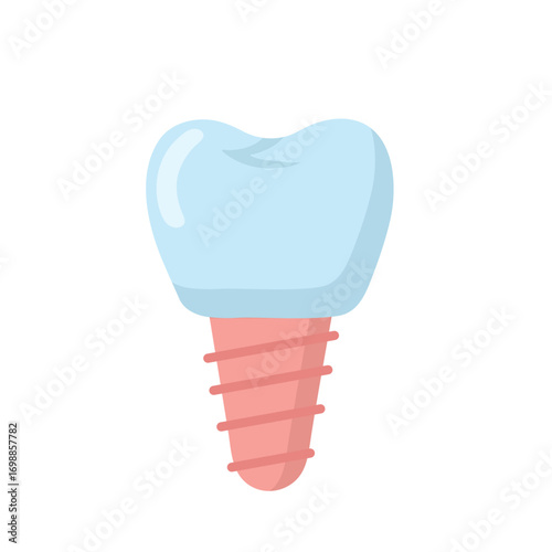 Cartoon style dental implant illustration with blue crown and pink screw post, isolated on dark background. Ideal for oral surgery, tooth replacement, and dental education-themed stock content