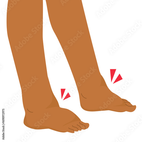 Medical cartoon illustration of a close-up pair of female legs with swollen feet and ankles, representing pain, health problems, pregnancy discomfort and treatment