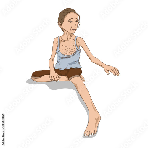 A starving child with a thin and malnourished body Hunger, malnourished, starvation. Famine, a girl so thin she was just skin and bones vector illustration