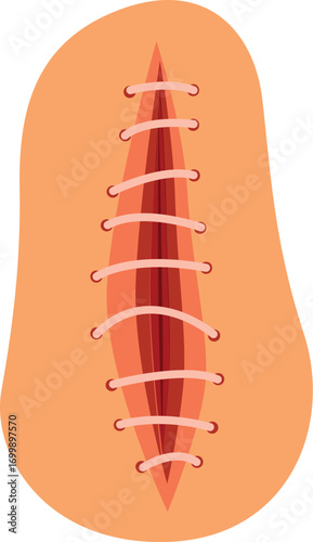 Stitches closing a wound after surgery, healing process of human skin