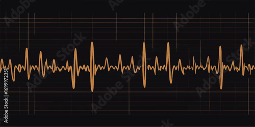 Green electrocardiogram wave line on a medical monitor showing a healthy heartbeat pulse