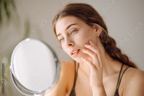 Fotografie Close-up of a young woman's face with rashes looking into a small mirror in a cozy room