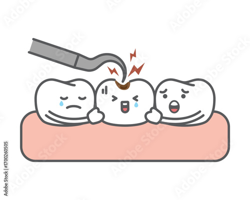 Vector illustration of cute anthropomorphic teeth characters, one with a painful cavity being examined by a dental instrument