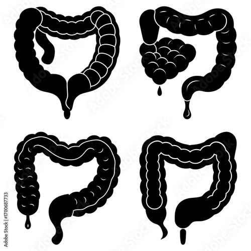 Illustrations of different colon shapes and conditions in black and white medical representation showing anatomy
