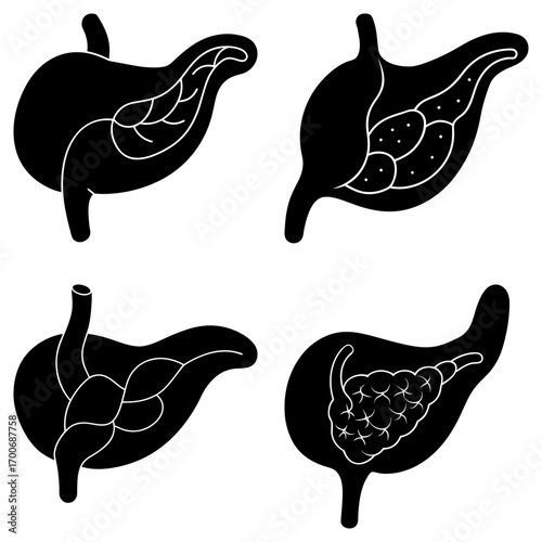 Anatomical illustrations showing different views of the stomach and pancreas in black and white silhouette