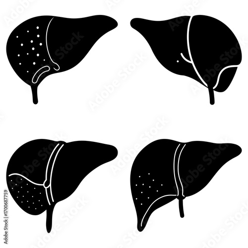 Four liver illustrations depicting different stages of liver disease in a simple black and white style