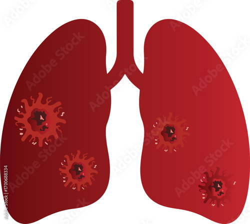 Vector of Lungs with Viral Infection