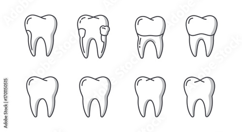 various dental conditions shown through tooth illustrations
