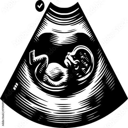 Echo of Life: A black and white depiction of a fetal ultrasound image, symbolizing the wonder of life and the miracle of pregnancy.