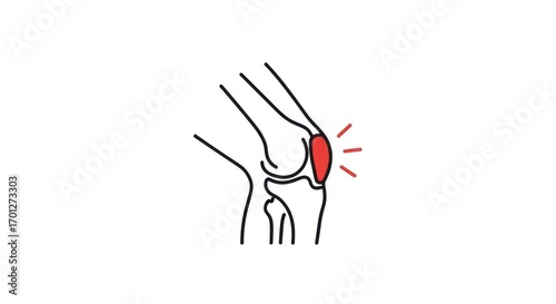 Stylized knee pain illustration, conveying discomfort or injury concept