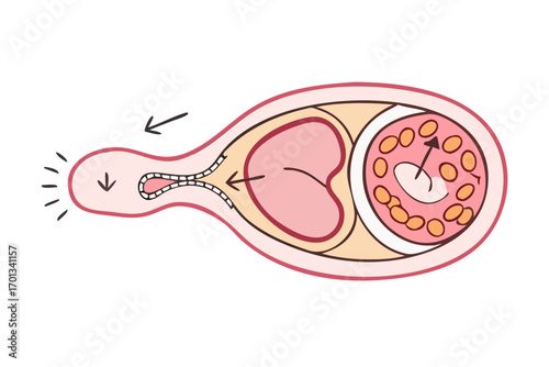 Illustration of sperm entering the fallopian tube to fertilize egg