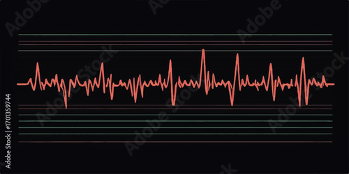 Healthy life and medicine concept: a green electrocardiogram wave with a heartbeat pulse on a black cardiogram monitor
