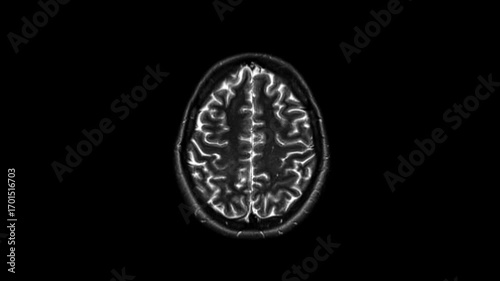 Black and White MRI Scan of Human Brain Detailed Cross Sectional Imagery Highlighting Intricate Anatomy and Neural Structures for Medical Diagnostic and Healthcare Analysis, Showcasing Complexity
