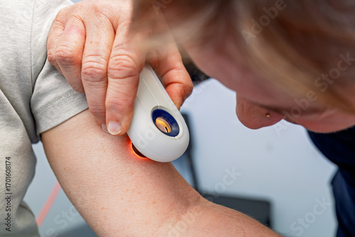 doctor nurse using dermoscope dermatoscope to examine skin lesion on patient arm, gp general practice australia, healthcare hospital clinic