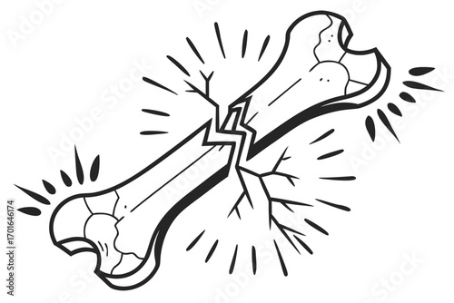 Broken Bone Illustration with Cracks and Rays.
