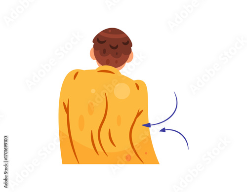 Scoliosis. Spinal deformity. Abnormal posture. illustration of a man with a curved back like the letter C. body health problems. Flat style character design. White background.