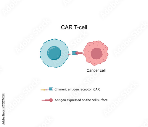 CAR T-cell therapy, killing of tumor cells. Cancer therapy. Chimeric antigen receptor T cell ,CAR T cell, for use in immunotherapy. Genetic engineering. Chemotherapy. Vector illustration.