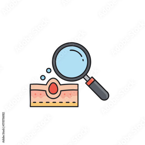 A magnifying glass examines a cross-section of skin showing a blemish, representing dermatological care and the study of skin health issues.
