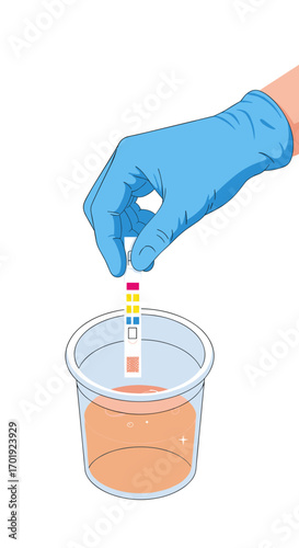 Medical laboratory technician performing urinalysis by dipping a dipstick into a urine sample for diagnostic testing and health monitoring purposes