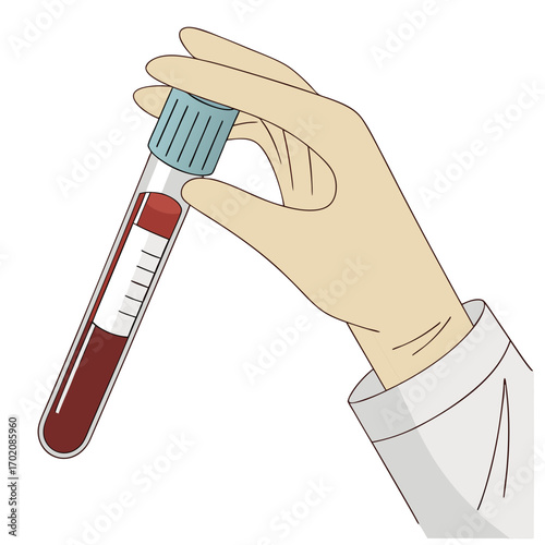 Medical professional holding blood sample vial for testing, showcasing healthcare innovation and lab research for disease diagnosis