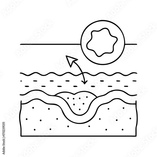 Skin Allergy or Irritation Reaction Line Icon, Skin Rash or Eczema Medical icon

