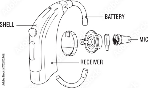 Exploded View Diagram of a Behind-the-Ear Hearing Aid Components