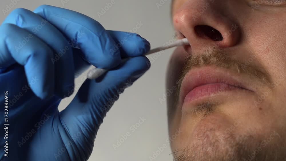 Stockvideon Nasal Swab Test For Viruses Test For Infections And Stockvideon Nasal Swab Test For Viruses Test For Infections And