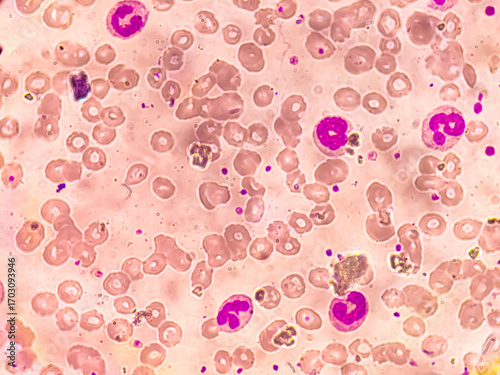 Human red blood cells, white blood cells and platelets isolated on white background, concept for medical health care.